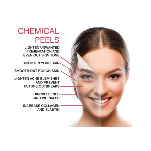 Chemical Peel Facial Denver